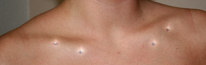 cuckold erfahrungen dermal anchor blutet cuckold erfahrungen dermal anchor blutet